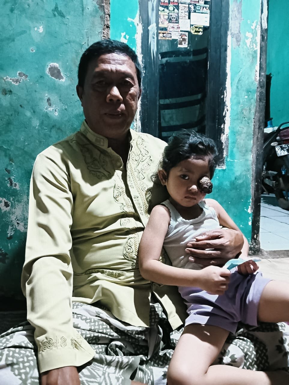 Kades Pagenjahan Sambangi Anak Penderita Tumor Mata, Harapkan Penanganan Khusus dari Dinas Kesehatan