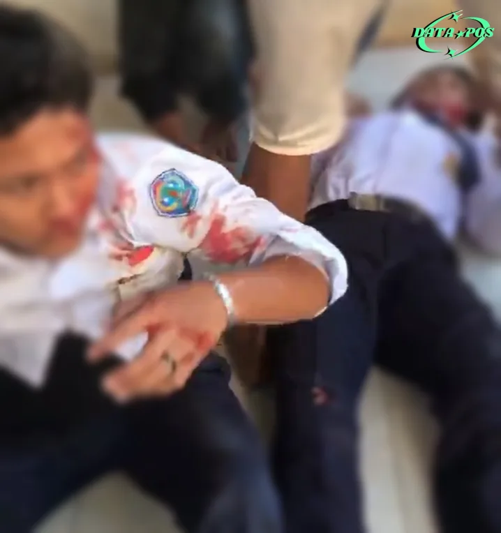 Kepulangan Lebih Awal Berujung Kecelakaan: Dua Siswa SMP Terlibat Senggolan Motor